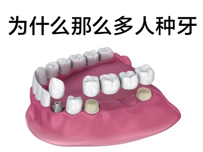 天津70岁老人适合种牙还是镶牙 为什么选择种植牙