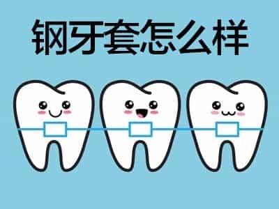 天津哪种牙齿矫正好用？不不同矫正方式适合什么情况