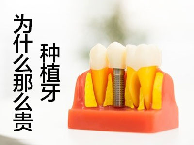 天津美国百康整口种植牙价格清单 种植牙价格