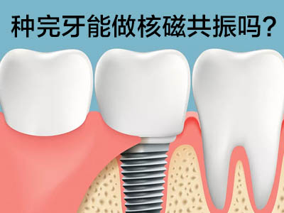 天津有种植牙能做核磁共振检查吗