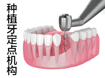 口碑好的口腔医院 天津医院牙科种牙收费价目表