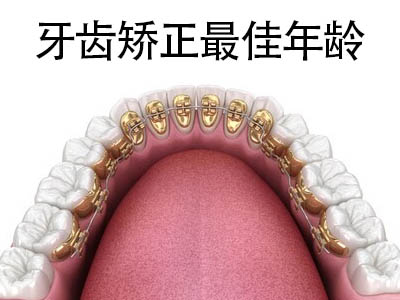 天津市正颌手术费用-牙齿矫正多少钱?