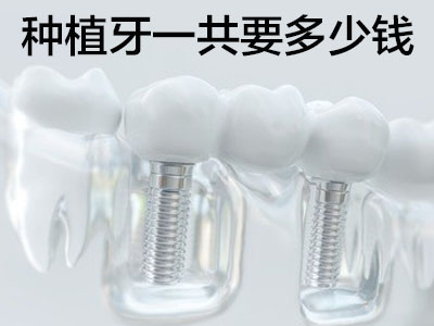 天津法国安卓健全口种植牙价格清单