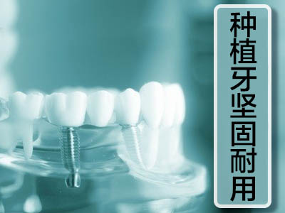 法国种植牙品牌 天津法国安卓健半口种植牙费用表