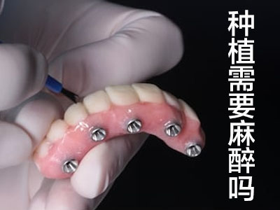 天津种植牙和全瓷牙有什么区别-如何选择？