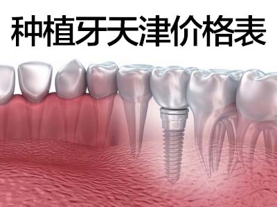 植牙天津市口腔医院多少钱