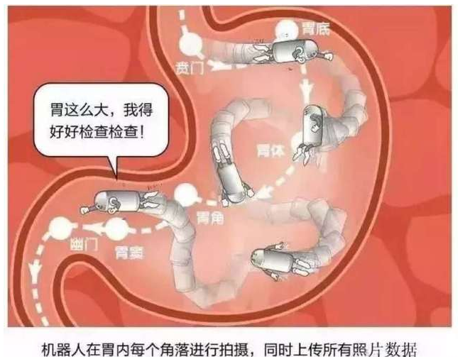 南宁东大医院的这颗磁控胶囊胃镜机器人，无痛无创十多来分钟轻松检查搞定~