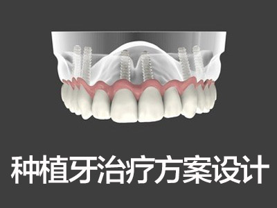 天津整口种植牙口腔医院一共多少钱