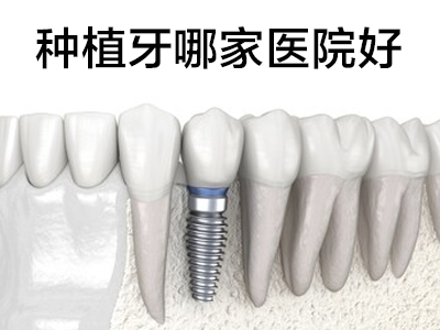 天津市半口全口种植牙种植牙医院哪家好