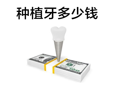 天津法国安卓健整口种植牙要花多少钱