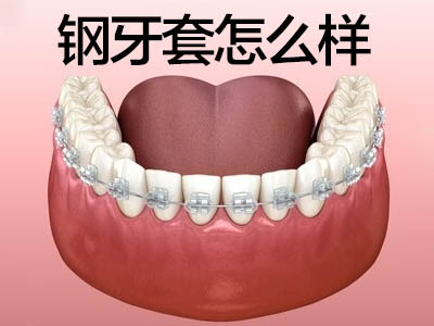 天津正畸哪家好-牙齿矫正哪家口腔医院值得信赖？