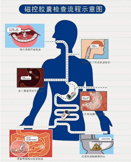 南宁东大医院推出这颗微型胶囊机器人，大家再也不用怕做胃镜检查痛苦啦~