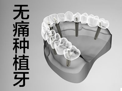 天津北辰市口腔医院种植牙价格表