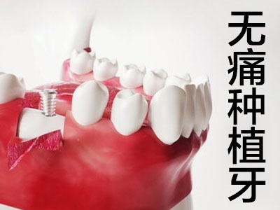 天津武清种植牙的价格表-种植牙多少钱？