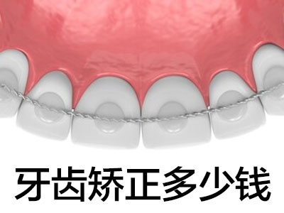 天津和平区牙科收费价目表2021-牙齿矫正价格表