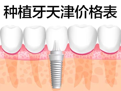 百康种植体好不好？天津美国百康半口种植牙多少钱？