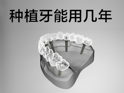 天津半口种植牙可以用多久寿命