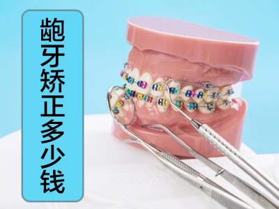 天津和平区戴牙套一般要花多少钱