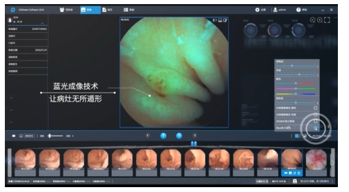 南宁东大医院推出胶囊胃镜检查来啦!服下一粒胶囊，胃里面“侦察兵”就上线~