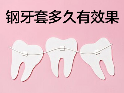 戴牙套每个月变化图   天津口腔医院牙齿矫正