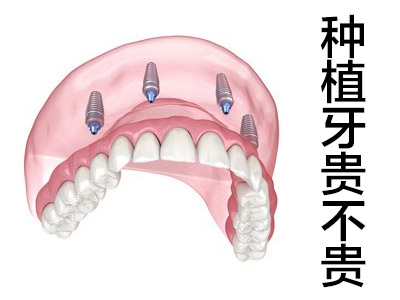 种植牙能修复全口牙齿吗？天津做个全口种牙多少钱？