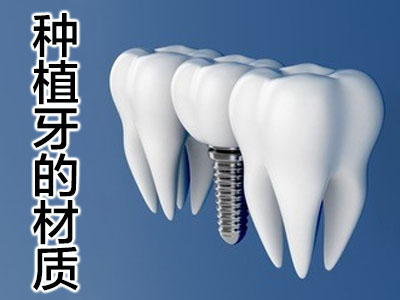 种植牙齿安卓建 天津法国安卓健全口种植牙收费标准