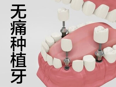 了解天津武清种植牙的价格表-种植牙多少钱？