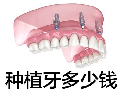 半口种植牙过程 天津做半口牙种植费用大概需要多少钱?