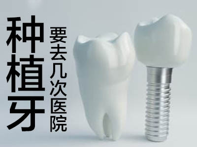 天津市满口种植牙口腔医院哪家好