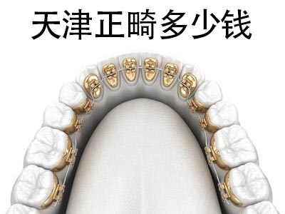 天津用隐形牙套矫正3颗牙齿要多少钱