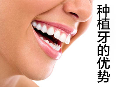 天津半口牙种植种六颗真实案例