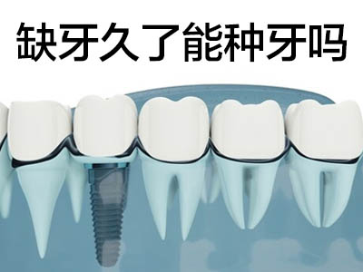 天津全口种植牙初期戴固定义齿好吗