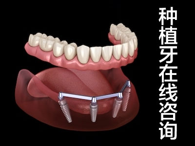 种植半口牙  天津半口牙齿缺失当选种植牙修复