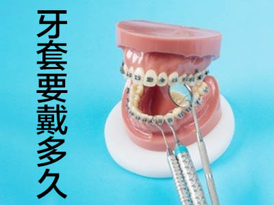 钢牙套价格  天津现在矫正牙齿钢牙大概多少钱?