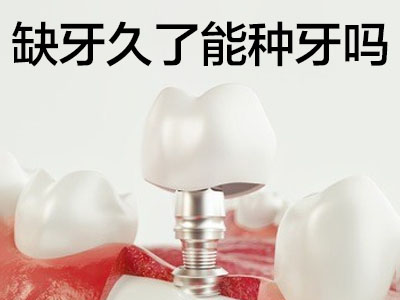天津全口种植牙的价格是多少钱-种植牙价目表