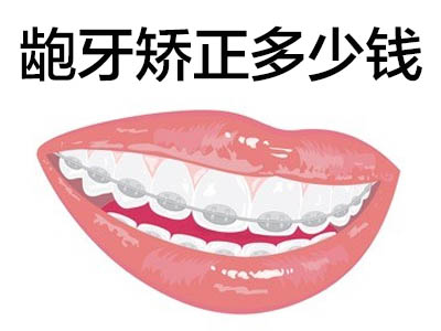 详细的天津隐形牙套牙齿矫正一般要花多少钱一颗