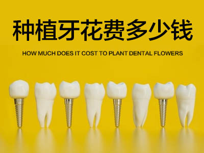 天津下颌全口种植牙价格是多少