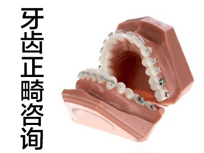 隐形牙套价格 天津牙齿矫正后戴的牙套价格一般是多少钱一个?