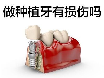 全牙冠种植技术  天津全口牙缺失怎么做种植牙