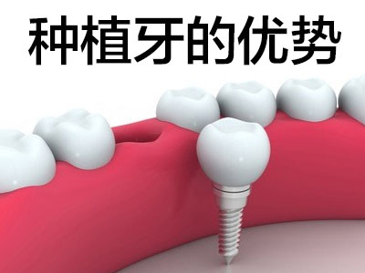 满口种植牙效果图 天津半口牙的种植效果怎么样?