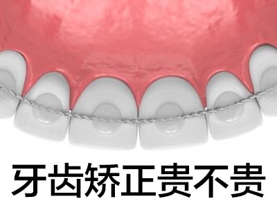 隐形牙齿矫正费用 天津隐形矫正牙齿比一般矫正贵多少钱
