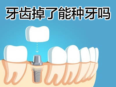 天津半口牙种植种六颗真实案例