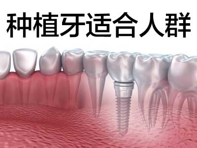 种植牙全新价格 天津一般全口种植牙的价钱是多少