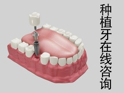 天津半口牙缺失一般要种植几颗牙