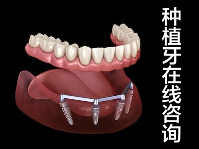 口腔种植修复 天津全口牙缺失种植方案及修复方式