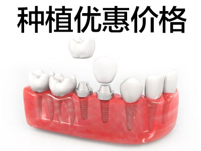 天津60岁老人种植全口牙需多少钱