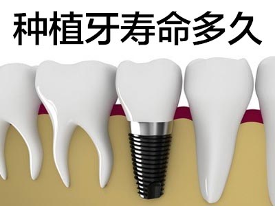 种植牙价格表 天津树脂种植半口牙需要多少钱