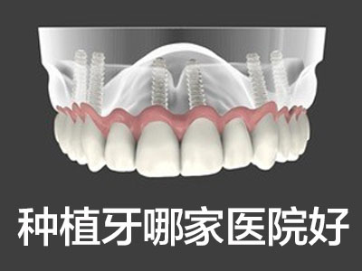 洪洞种植牙
