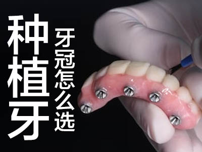 了解详细半口种植牙的步骤 中诺口腔刘子豪技术牙医