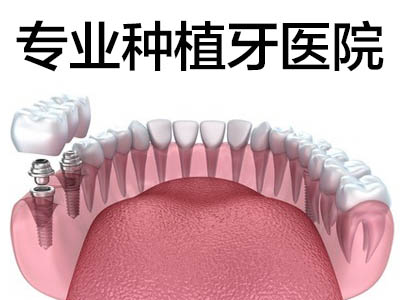 种植牙和镶牙有啥区别  天津镶牙好还是种植牙好该如何选择?